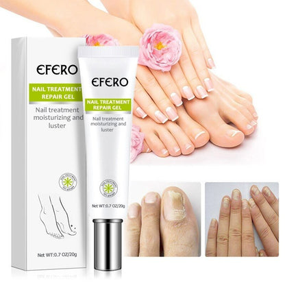 Efero QuickNail Fix™⎪Repariere deine Nägel im Handumdrehen