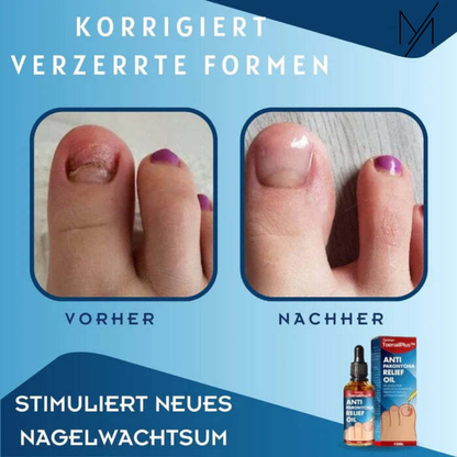 ToeRelief™⎪Ihre Lösung für gesunde Zehen