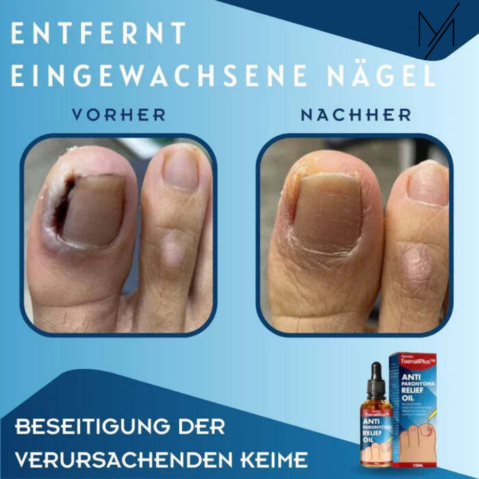 ToeRelief™⎪Ihre Lösung für gesunde Zehen