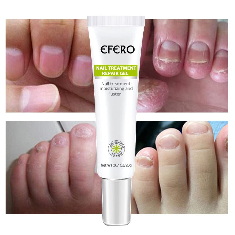 Efero QuickNail Fix™⎪Repariere deine Nägel im Handumdrehen