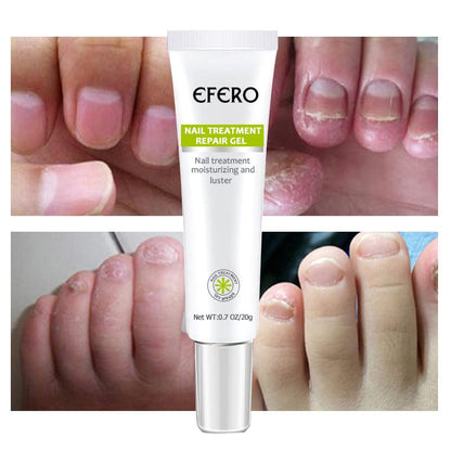 Efero QuickNail Fix™⎪Repariere deine Nägel im Handumdrehen