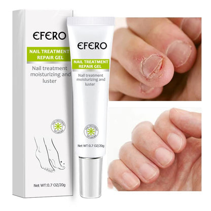 Efero QuickNail Fix™⎪Repariere deine Nägel im Handumdrehen