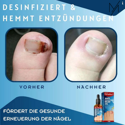 ToeRelief™⎪Ihre Lösung für gesunde Zehen