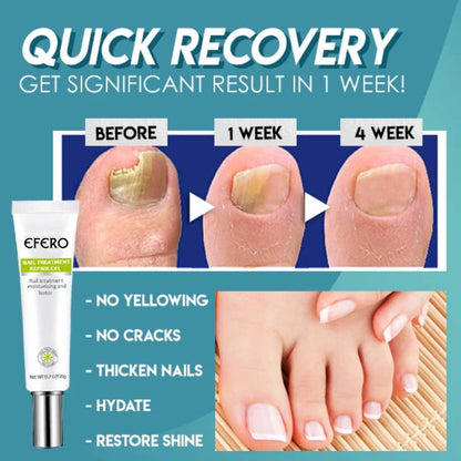 Efero QuickNail Fix™⎪Repariere deine Nägel im Handumdrehen